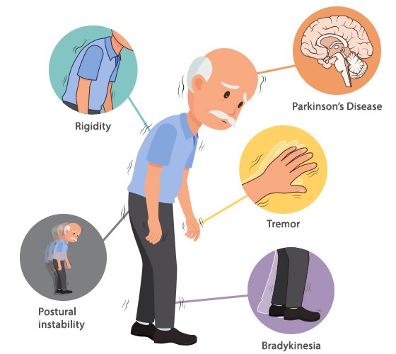 Parkinsons
